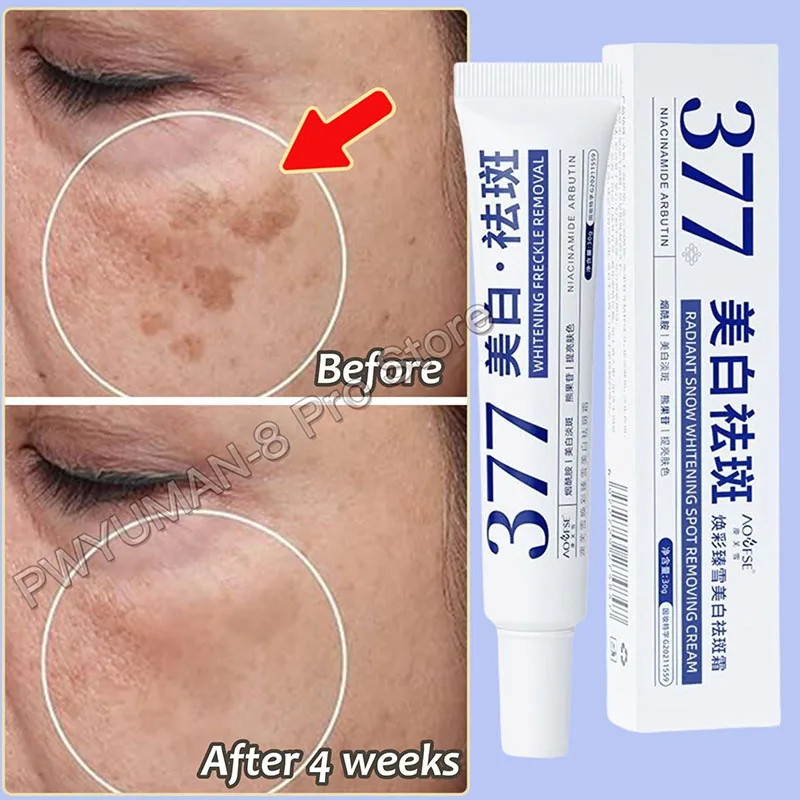 Niacinamide Whitening Spot Removal Cream Dark Spot Corrector Face Cream Melasma Freckle Sun Spot Remover Brighten Anti-Aging 30g