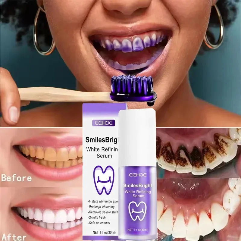 Teeth Cleansing Whitening Toothpaste Whiten Gel Whitener Bleach Removes Stains Fresh Breath Tooth Cleaning Korea Products