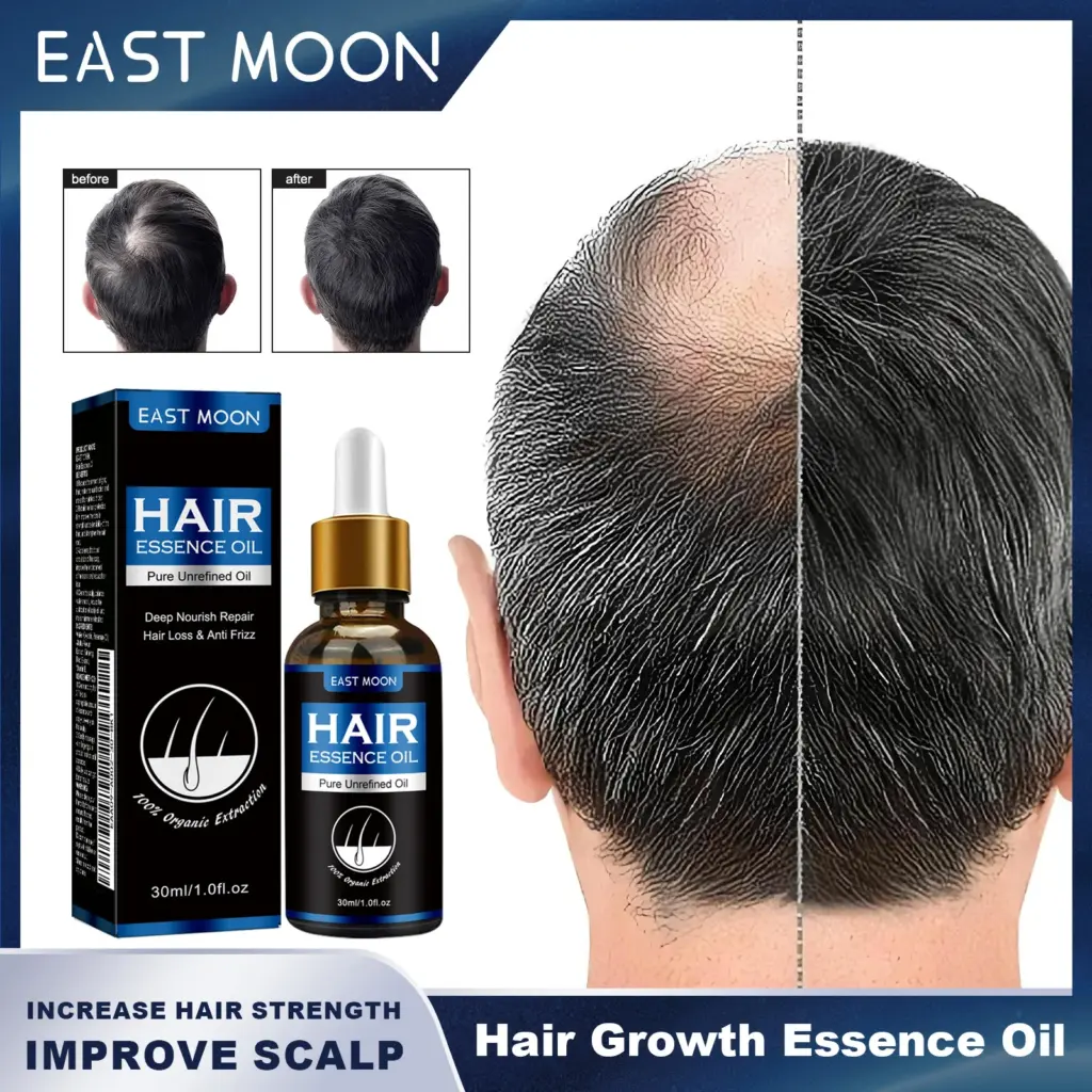 East Moon Vitamin E Hair Growth Essence Oil Reduce Gray Hair Increase Hair Strength Black And Shiny Improve Scalp Reduce Oil