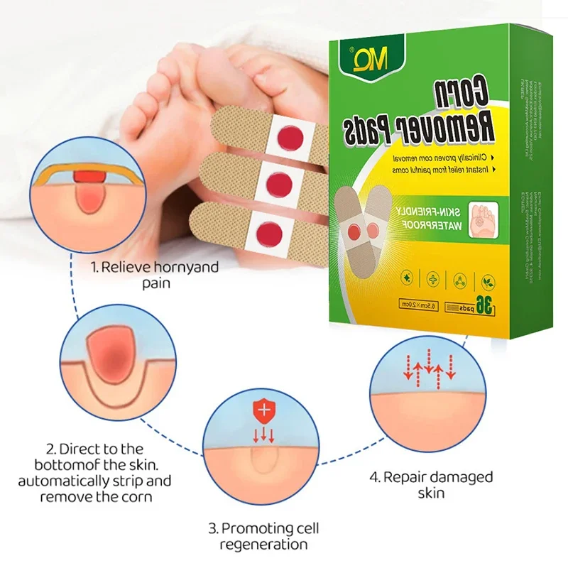 36PCS Foot Care Sticker Medical Patch Corn Removal Pads Curative Patches Calluses Remove Callosity Detox Summer Foot Care Tools