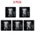 I 5PCS