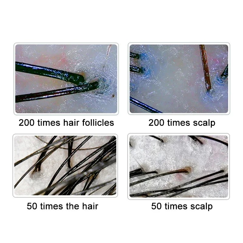 2026 HD Digital Skin Analyzer Professional Hair Scalp Camera Detector Hair Follicle Oil Moisture Test Device 10inch 50/200X