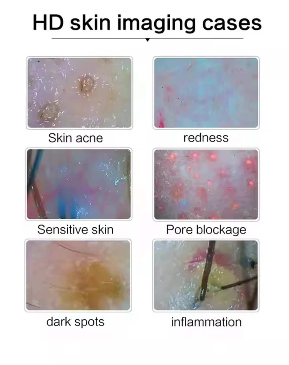 2026 HD Digital Skin Analyzer Professional Hair Scalp Camera Detector Hair Follicle Oil Moisture Test Device 10inch 50/200X