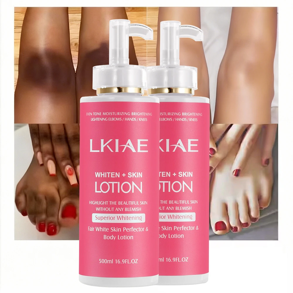 AILKE Superior Whitening Body Lotion, Moisturizing, Smooth Skin, Reduce Dark Spots, With Rose Essential Oil, Niacinamide, 500ml