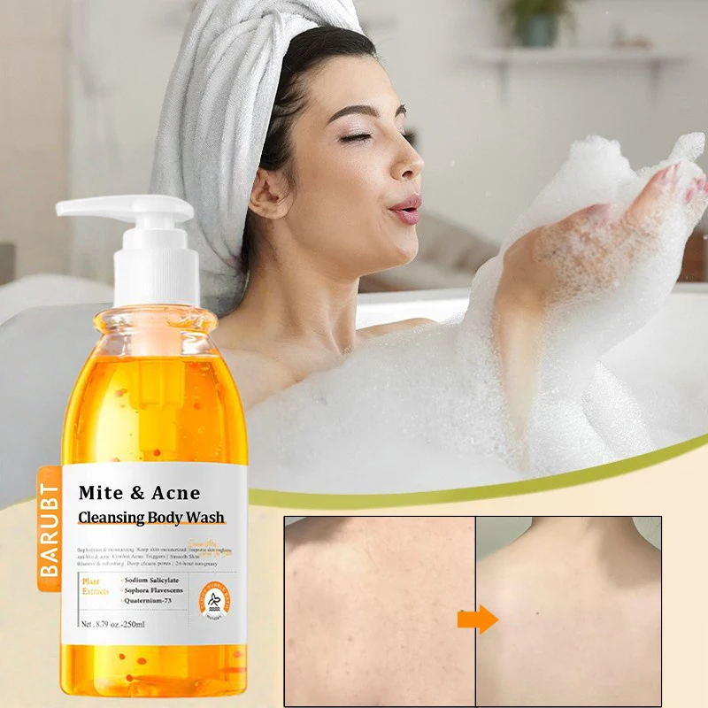 Mite & Acne Cleansing Body Wash Brand Oil Control Cleanses Pores Gentle Moisturizing Smooth Skin Unisex Cleansing Body Wash250ml