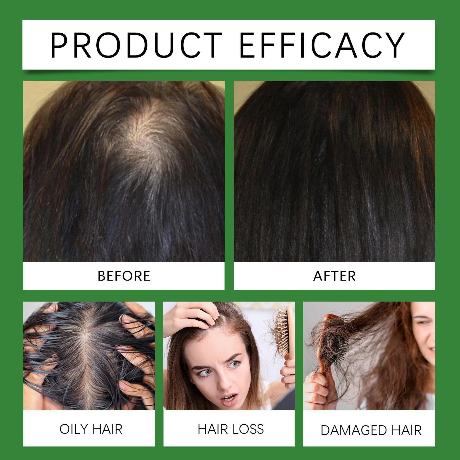 Rosemary Rice Water Hair Growth Spray with Peppermint Biotin Advanced Scalp Treatment for Thinning Hair Regrowth for Men & Women